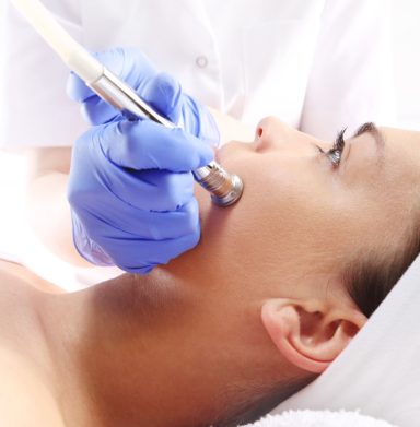 Frau erhält eine Microdermabrasion Behandlung