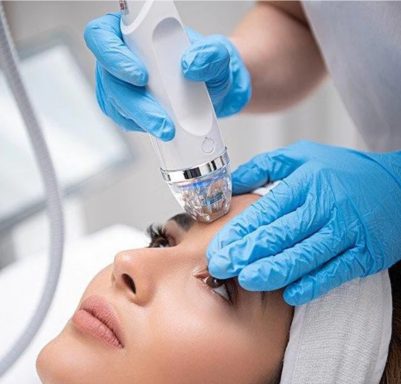 Frau erhält eine Radiofrequenz-Microneedling Behandlung