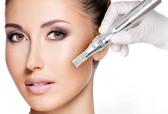 Frau erhält eine Microneedling-Behandlung